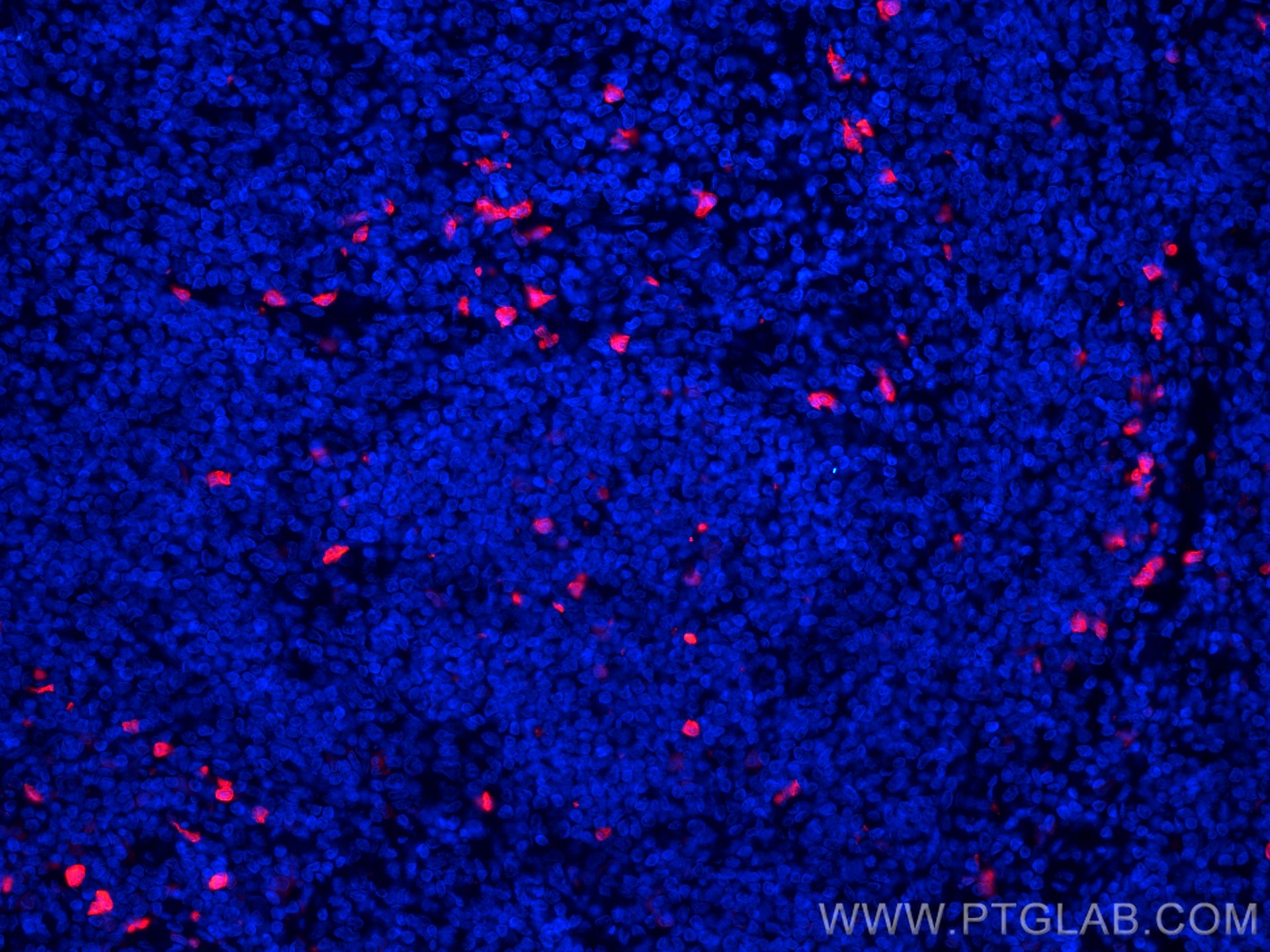 IF Staining of human tonsillitis using CL594-66853