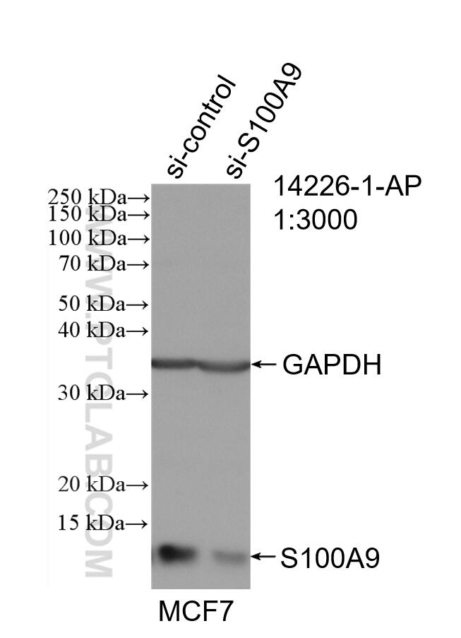 Western Blot (WB) analysis of MCF-7 cells using S100A9 Polyclonal antibody (14226-1-AP)