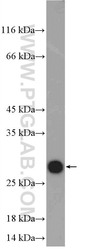 Western Blot (WB) analysis of mouse heart tissue using S100A9 Polyclonal antibody (14226-1-AP)