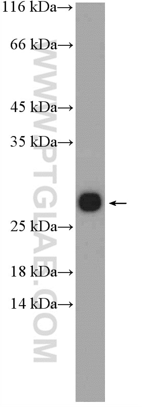 Western Blot (WB) analysis of rat heart tissue using S100A9 Polyclonal antibody (14226-1-AP)