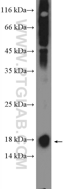 Western Blot (WB) analysis of human blood using S100A9 Polyclonal antibody (14226-1-AP)