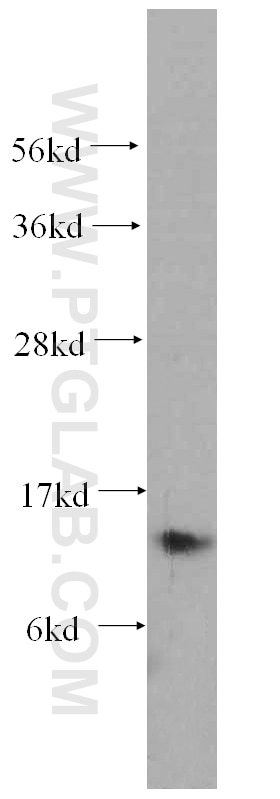 Western Blot (WB) analysis of human heart tissue using S100A9 Polyclonal antibody (14226-1-AP)