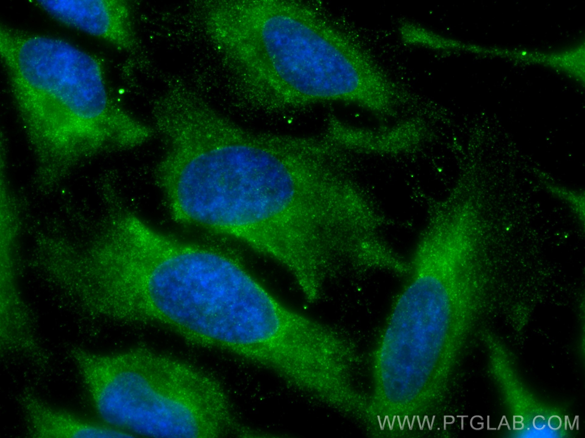 Immunofluorescence (IF) / fluorescent staining of HeLa cells using S100A9 Polyclonal antibody (26992-1-AP)