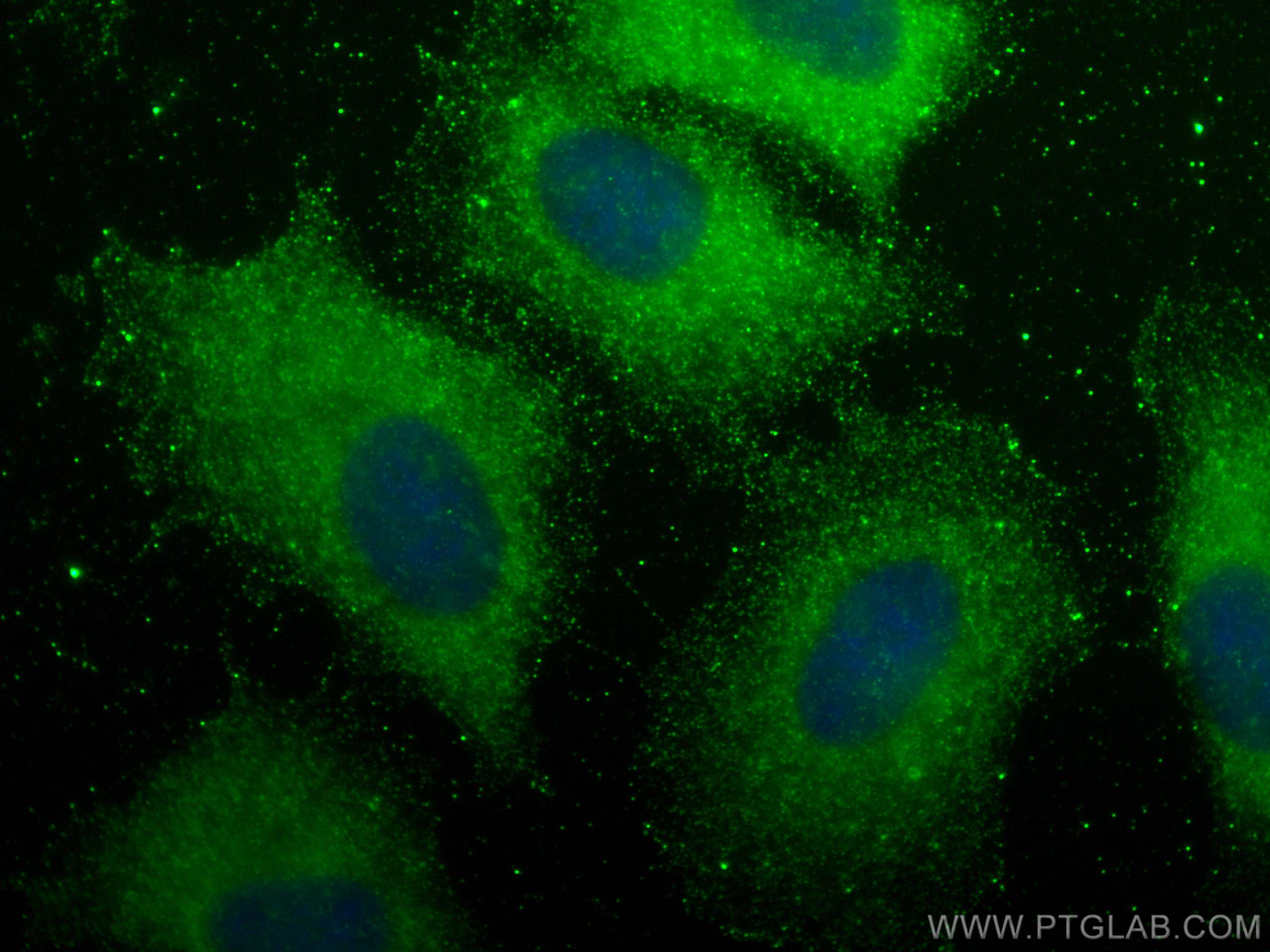 Immunofluorescence (IF) / fluorescent staining of A549 cells using S100A9 Polyclonal antibody (26992-1-AP)