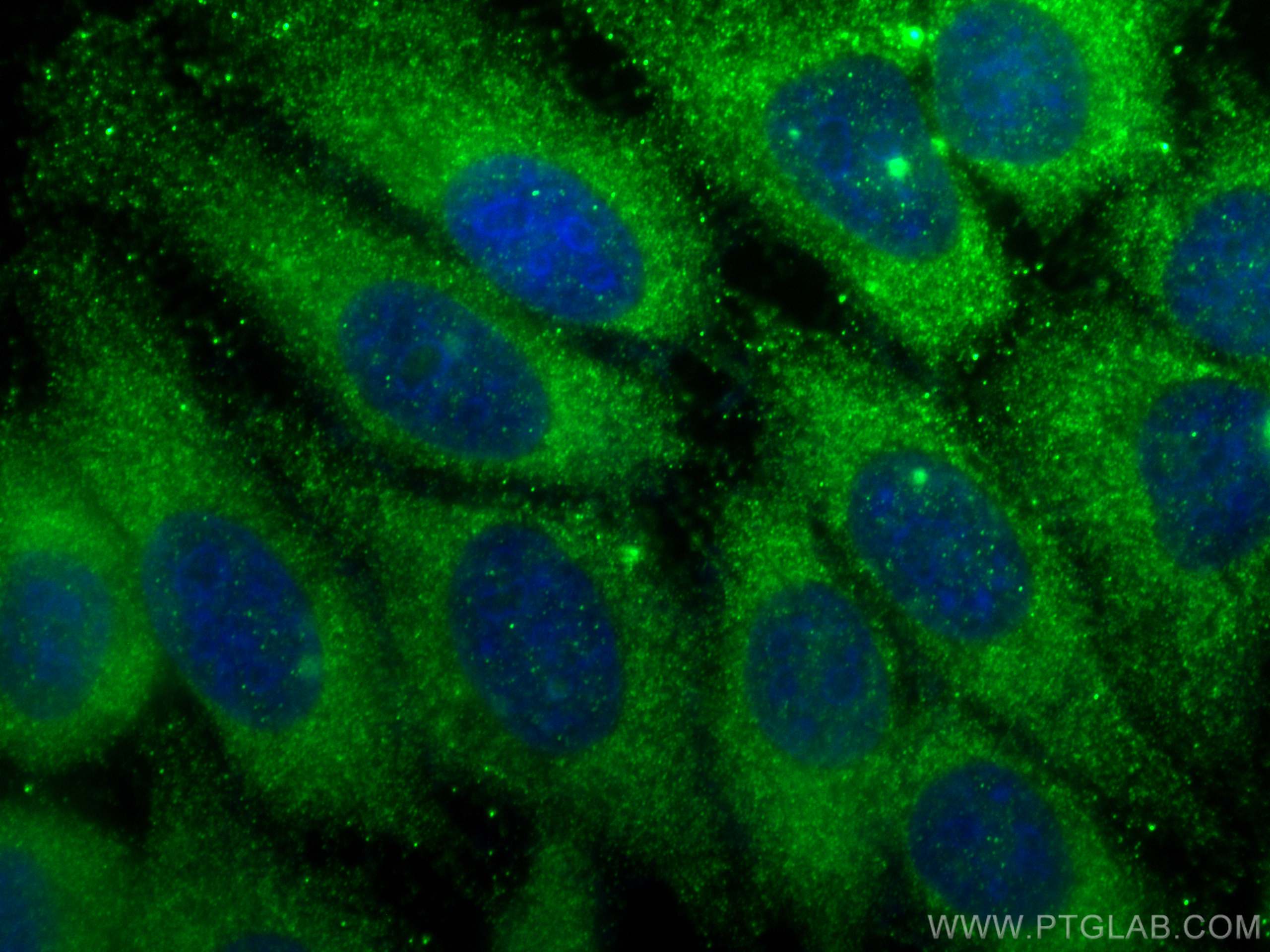 Immunofluorescence (IF) / fluorescent staining of HepG2 cells using S100A9 Polyclonal antibody (26992-1-AP)