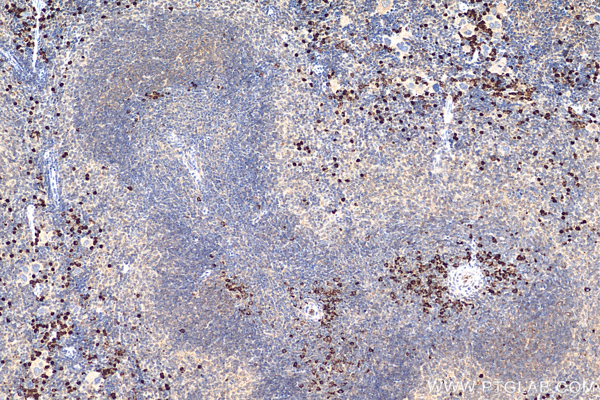 Immunohistochemistry (IHC) staining of mouse spleen tissue using S100A9 Polyclonal antibody (26992-1-AP)