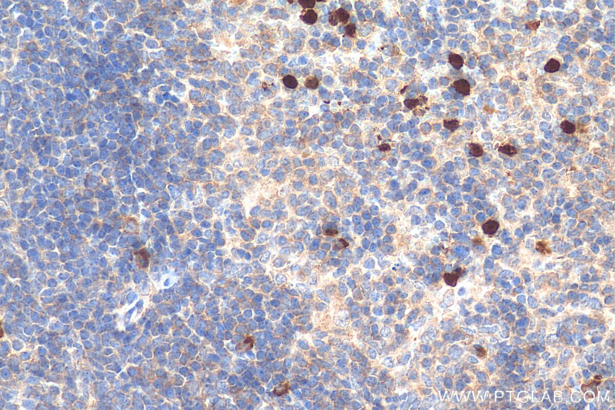 Immunohistochemistry (IHC) staining of mouse spleen tissue using S100A9 Polyclonal antibody (26992-1-AP)