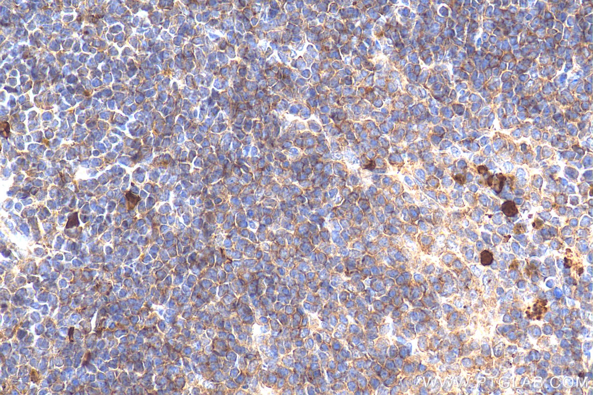 Immunohistochemistry (IHC) staining of mouse spleen tissue using S100A9 Polyclonal antibody (26992-1-AP)