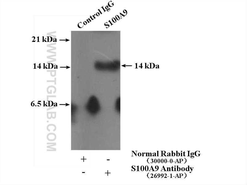 Immunoprecipitation (IP) experiment of MCF-7 cells using S100A9 Polyclonal antibody (26992-1-AP)
