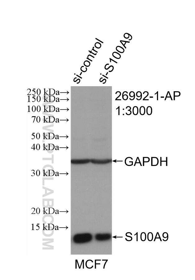 Western Blot (WB) analysis of MCF-7 cells using S100A9 Polyclonal antibody (26992-1-AP)