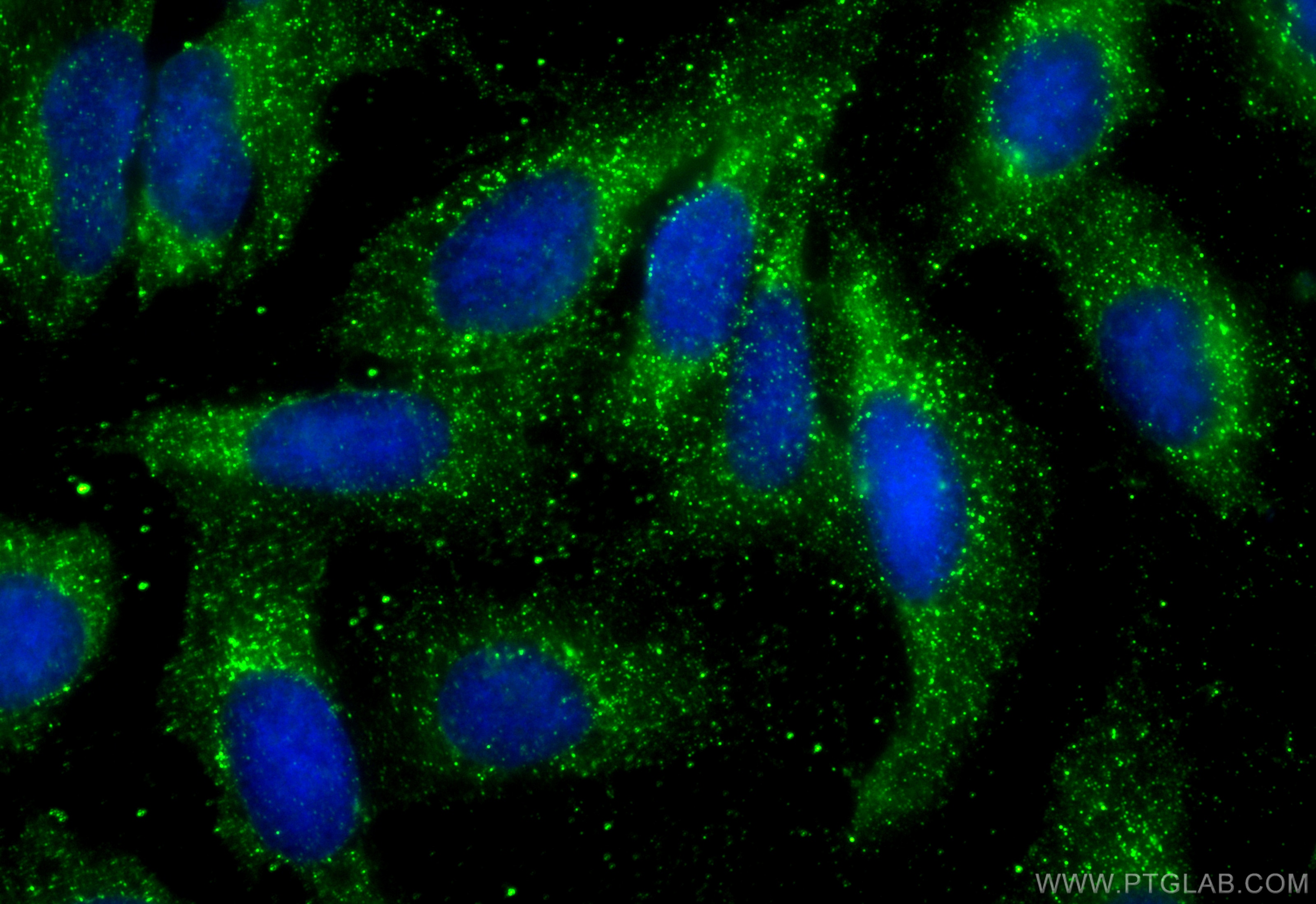 Immunofluorescence (IF) / fluorescent staining of U2OS cells using S100A9 Monoclonal antibody (68900-1-Ig)