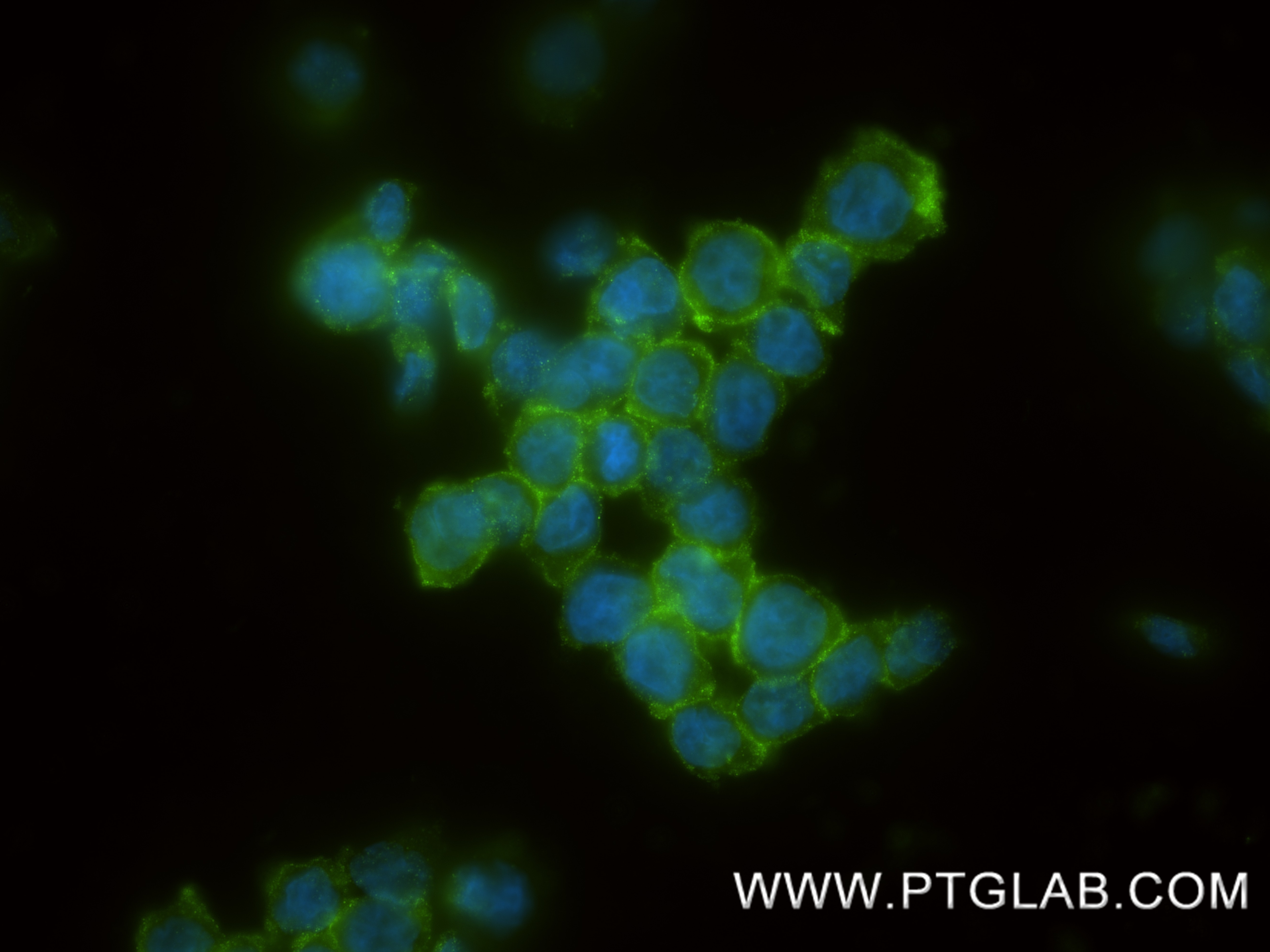 Immunofluorescence (IF) / fluorescent staining of THP-1 cells using S100A9 Recombinant monoclonal antibody (83578-2-RR)