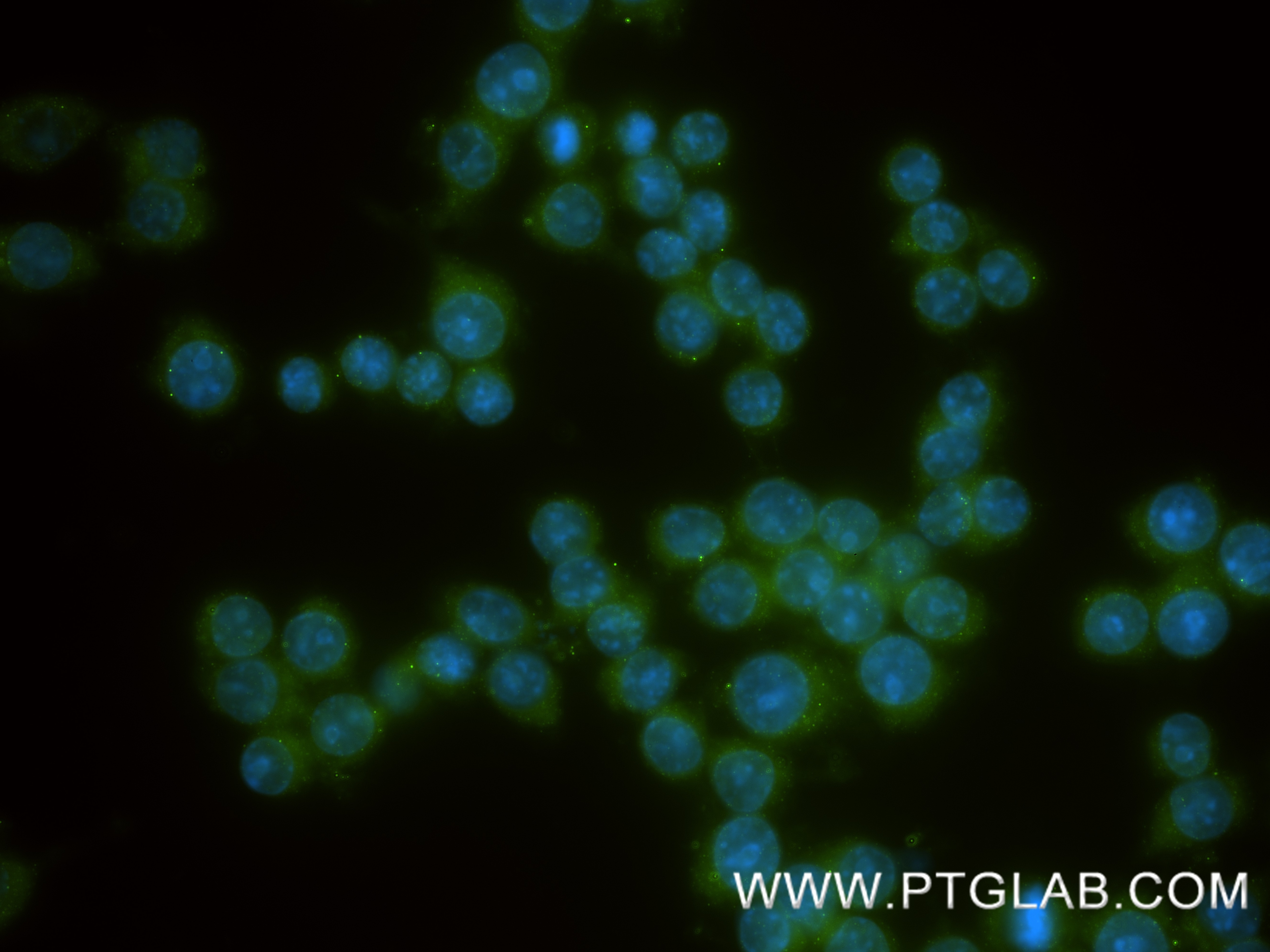 Immunofluorescence (IF) / fluorescent staining of RAW 264.7 cells using S100A9 Recombinant monoclonal antibody (83578-2-RR)