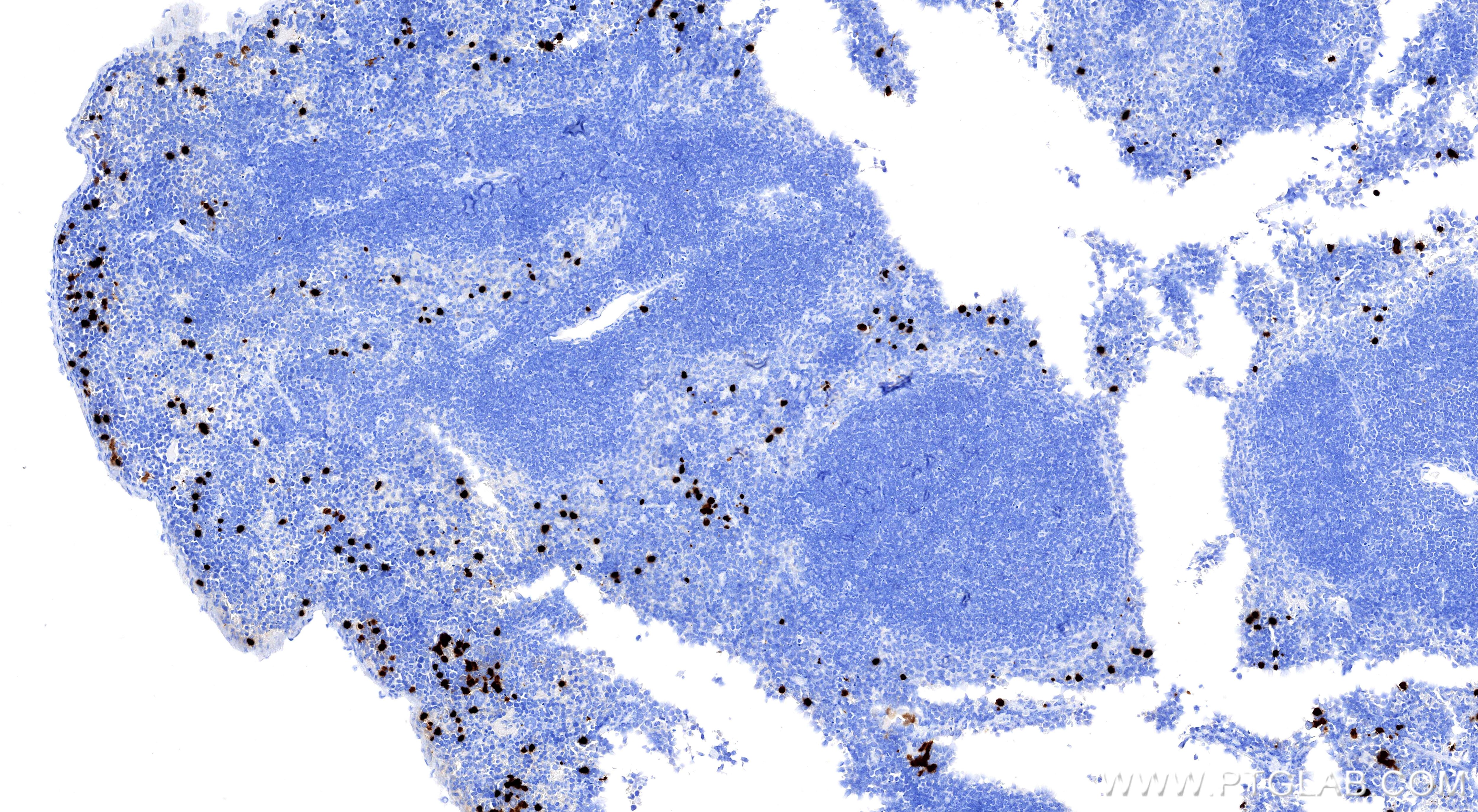 Immunohistochemical analysis of paraffin-embedded mouse spleen tissue slide using 98505-5-RR (S100A9 antibody) at dilution of 1:1000 (under 10x lens). Heat mediated antigen retrieval with Tris-EDTA buffer (pH 9.0). Immunohistochemistry (IHC) staining of mouse spleen tissue using Anti-Mouse S100A9 Rabbit Recombinant Antibody (98505-5-RR)
