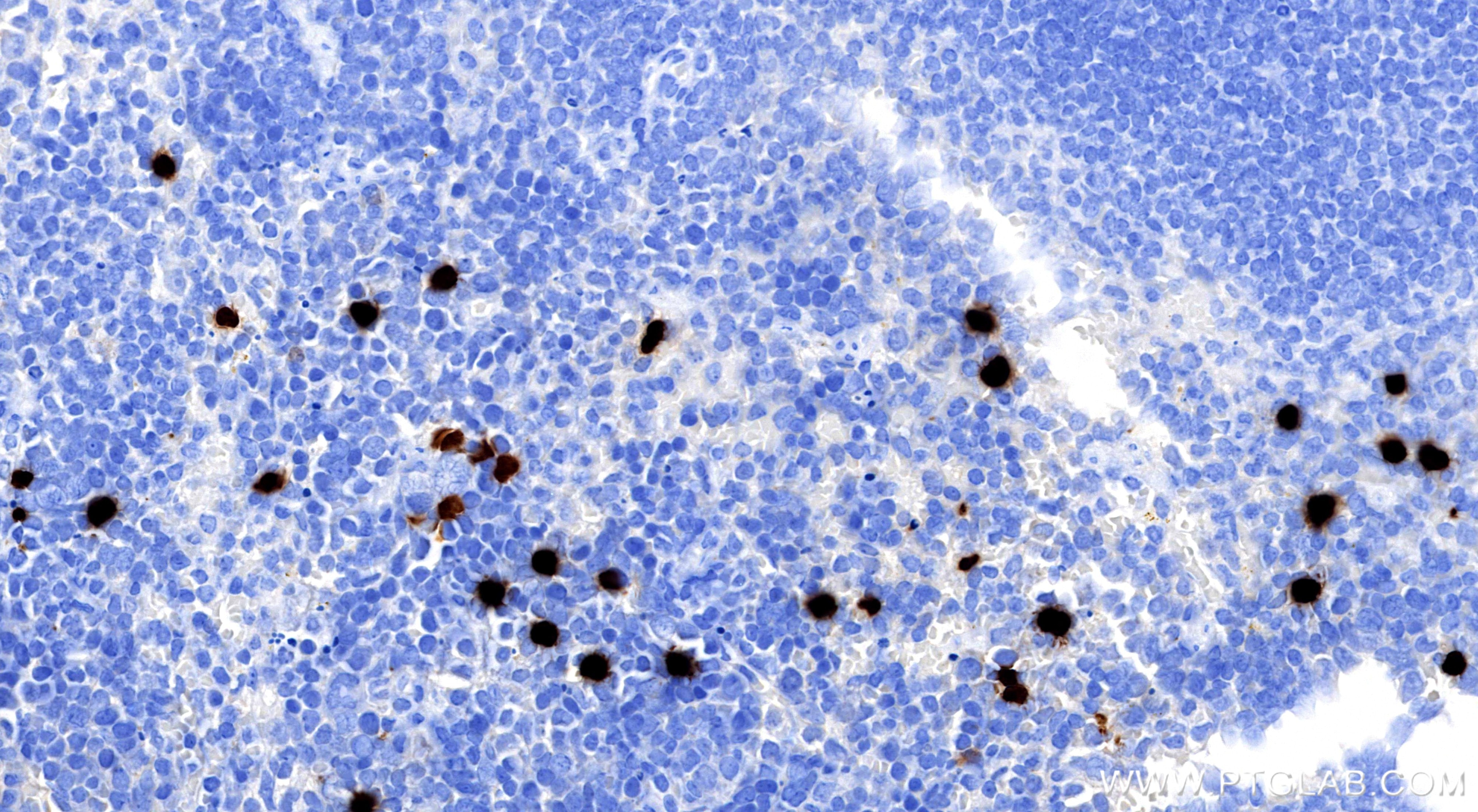 Immunohistochemical analysis of paraffin-embedded mouse spleen tissue slide using 98505-5-RR (S100A9 antibody) at dilution of 1:1000 (under 40x lens). Heat mediated antigen retrieval with Tris-EDTA buffer (pH 9.0). Immunohistochemistry (IHC) staining of mouse spleen tissue using Anti-Mouse S100A9 Rabbit Recombinant Antibody (98505-5-RR)