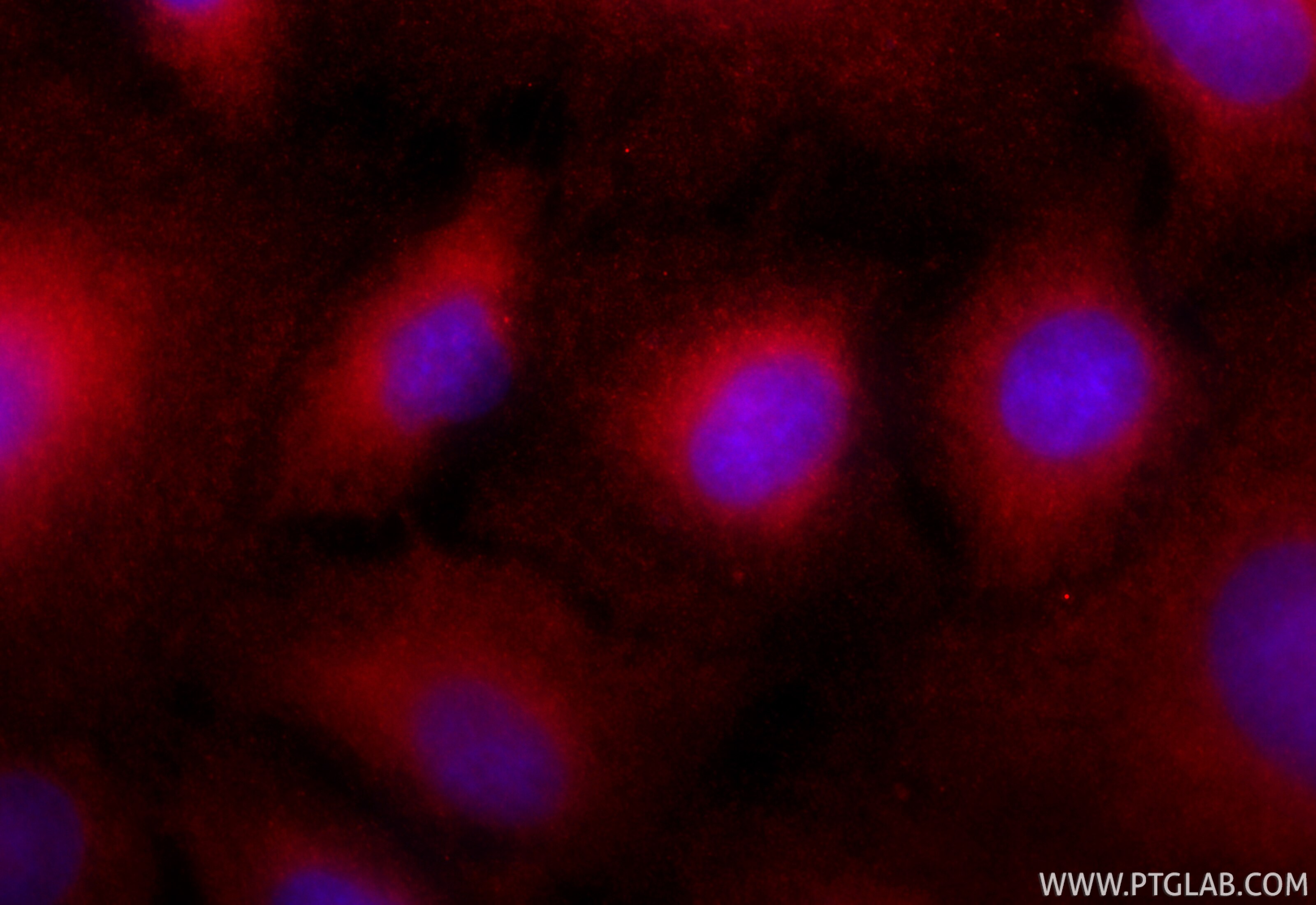 Immunofluorescence (IF) / fluorescent staining of A549 cells using CoraLite®594-conjugated S100A9 Polyclonal antibody (CL594-26992)