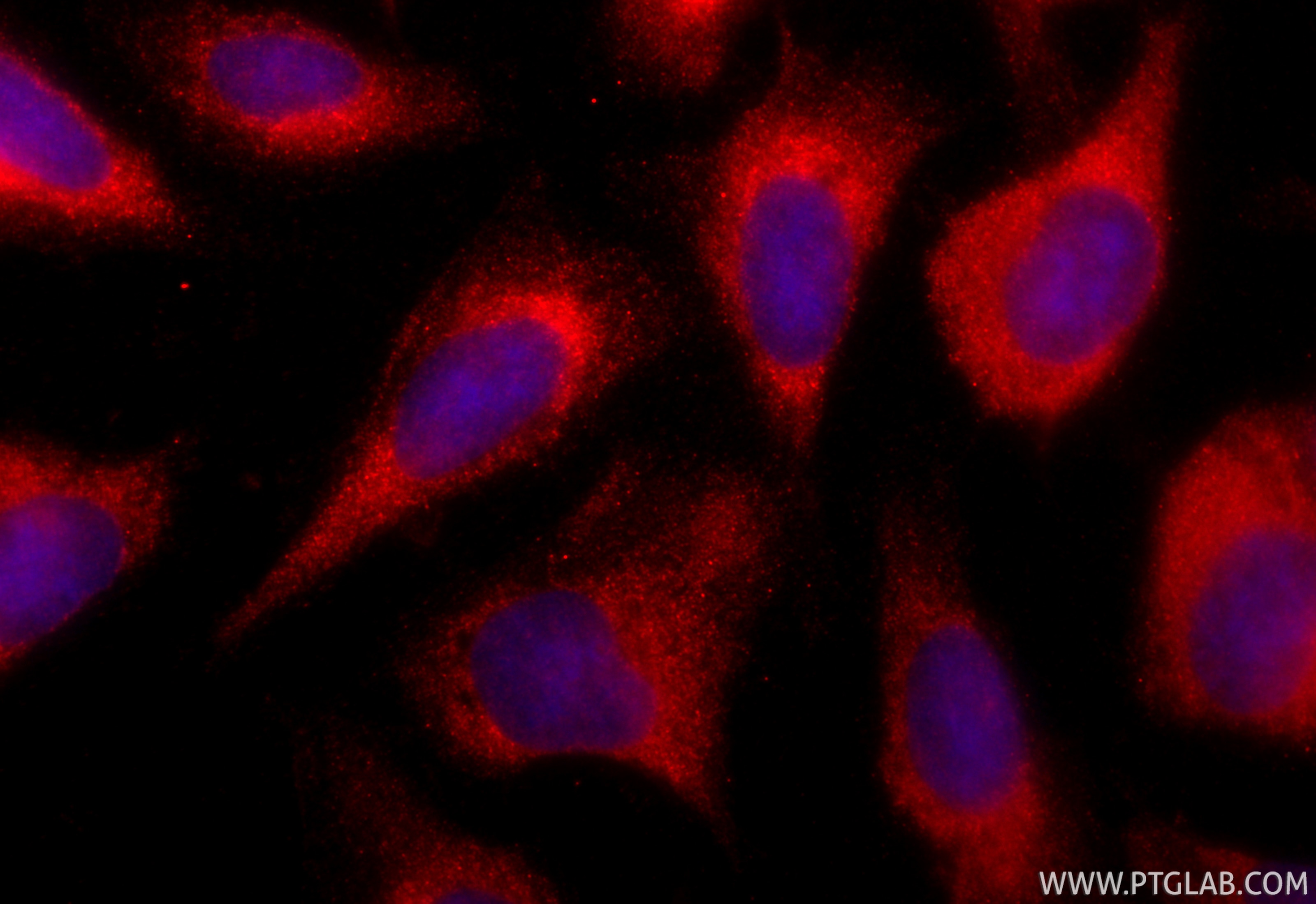 Immunofluorescence (IF) / fluorescent staining of U2OS cells using CoraLite®594-conjugated S100A9 Polyclonal antibody (CL594-26992)