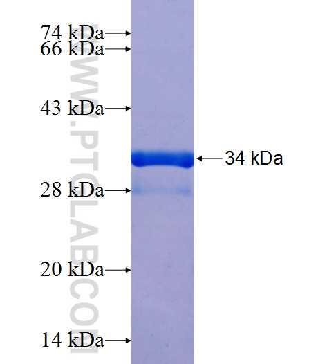 S100A9 fusion protein Ag25764 SDS-PAGE