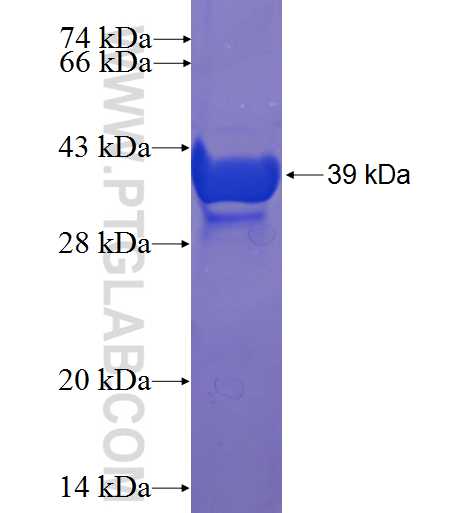 S100A9 fusion protein Ag5465 SDS-PAGE