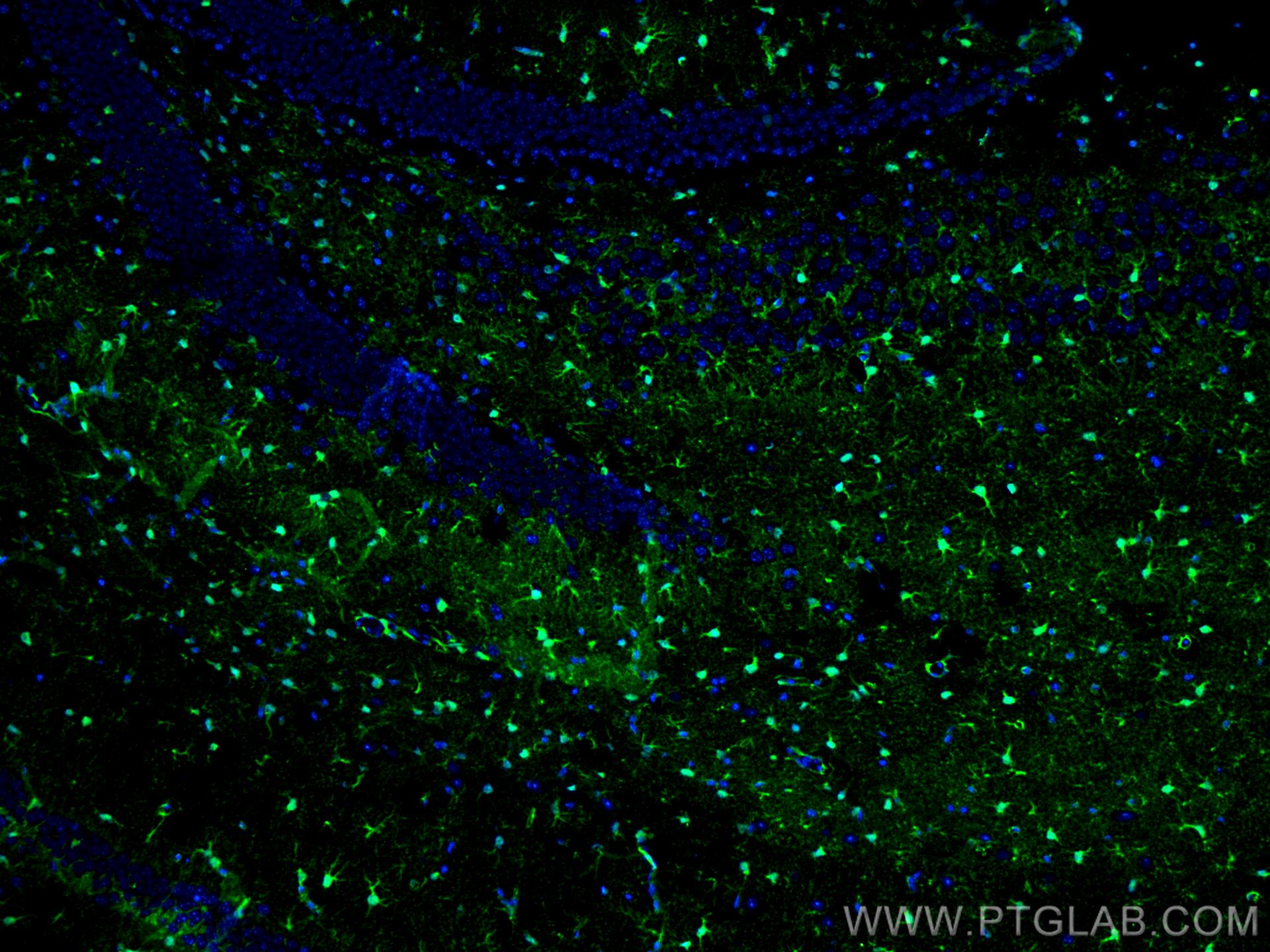 Immunofluorescence (IF) / fluorescent staining of mouse brain tissue using S100 Beta Polyclonal antibody (15146-1-AP)