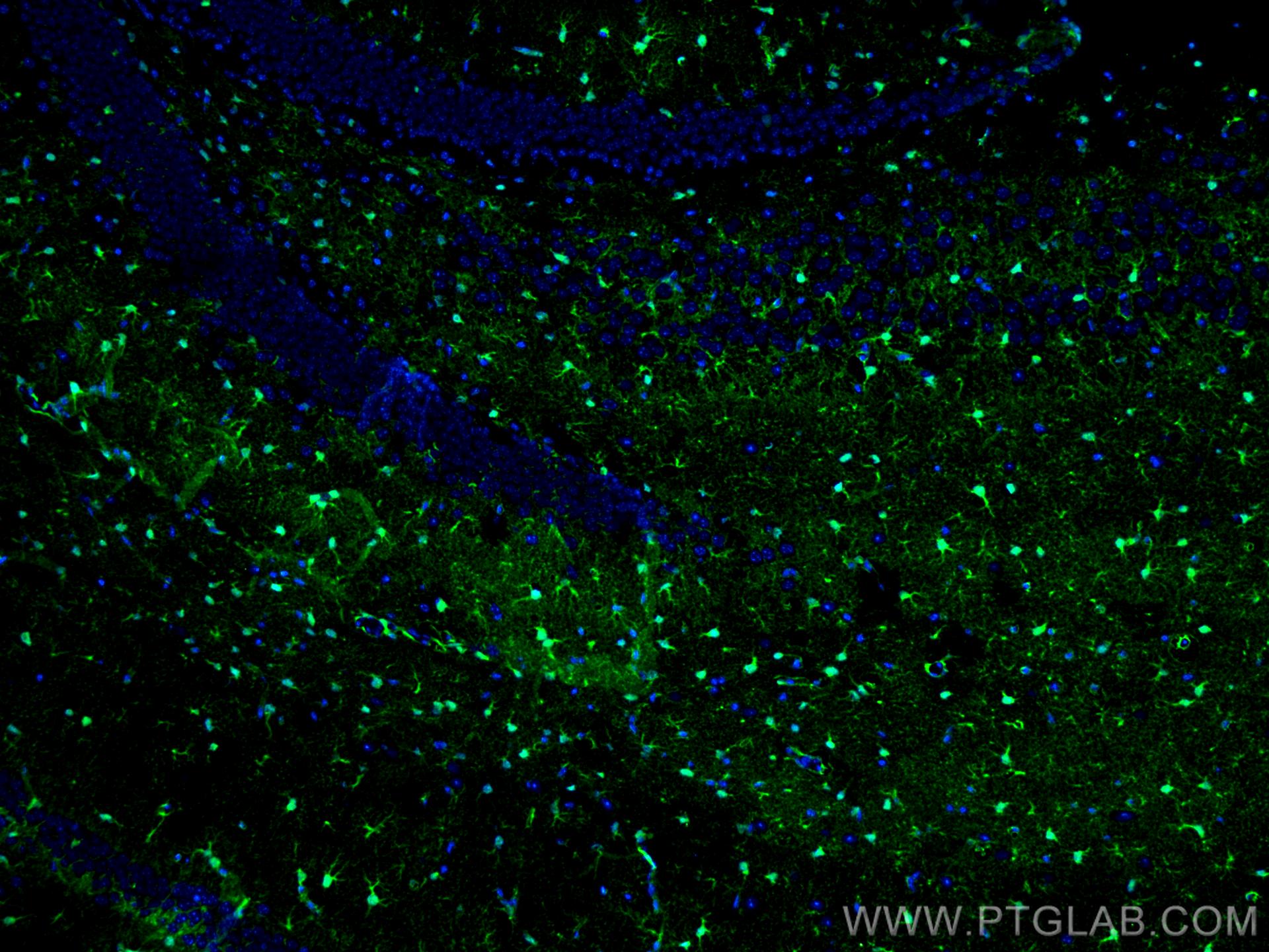 Immunofluorescence (IF) / fluorescent staining of mouse brain tissue using S100B Polyclonal antibody (15146-1-AP)