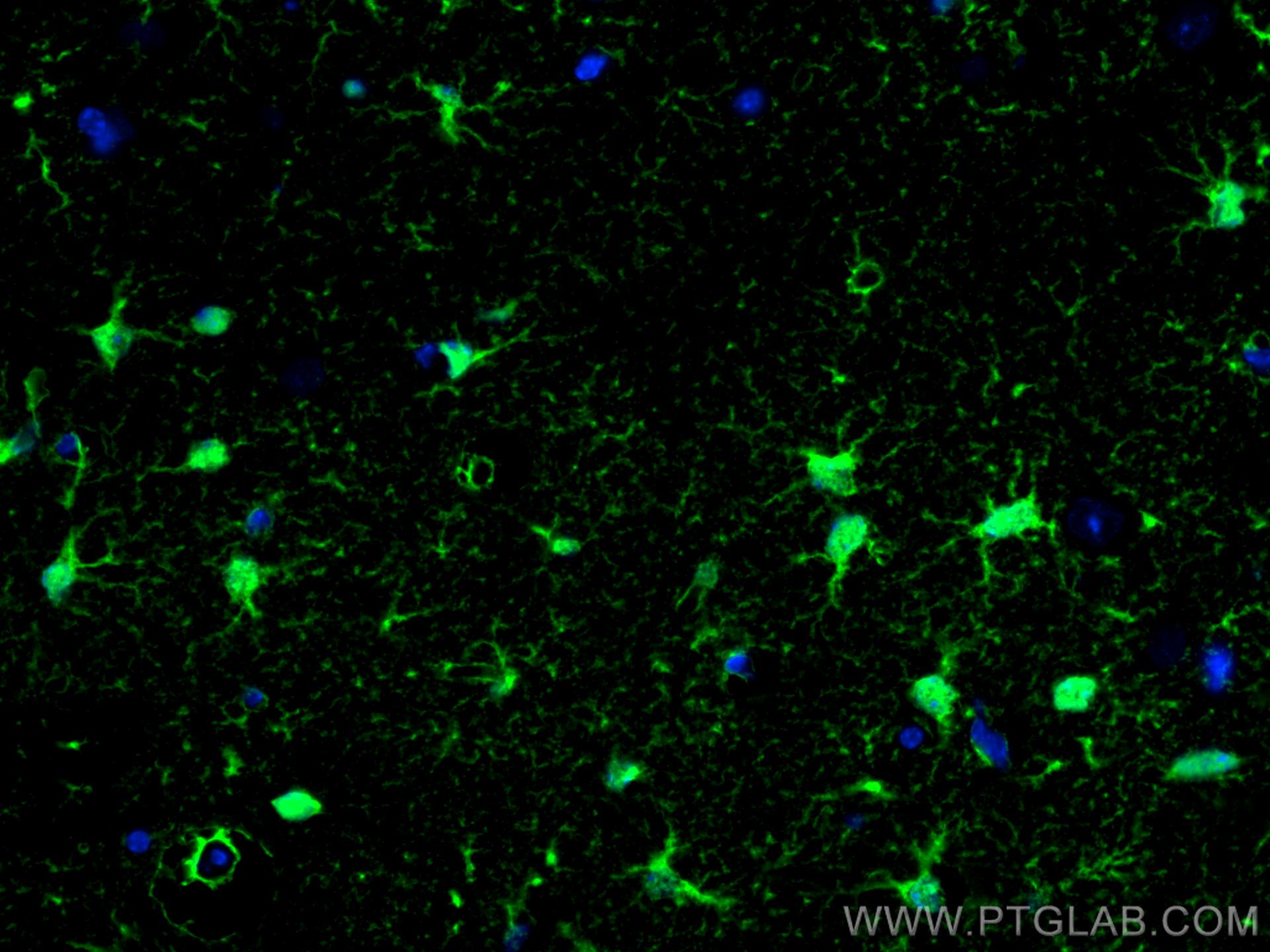 Immunofluorescence (IF) / fluorescent staining of mouse brain tissue using S100B Polyclonal antibody (15146-1-AP)