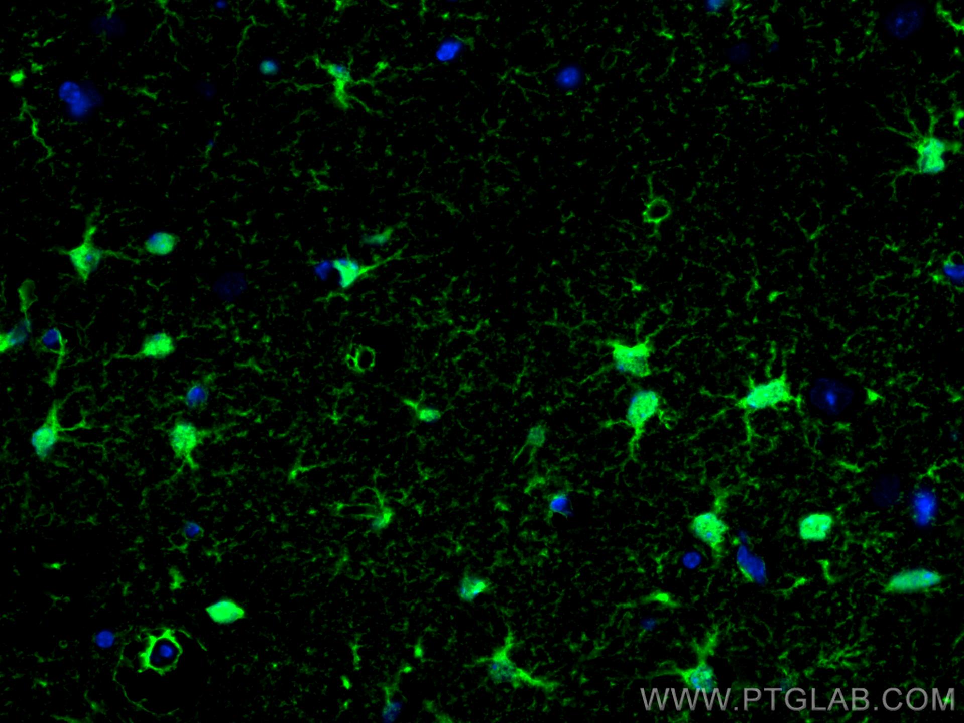 Immunofluorescence (IF) / fluorescent staining of mouse brain tissue using S100 Beta Polyclonal antibody (15146-1-AP)