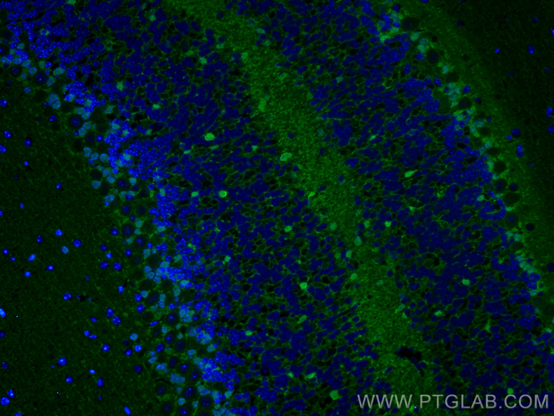 IF Staining of mouse cerebellum using 15146-1-AP