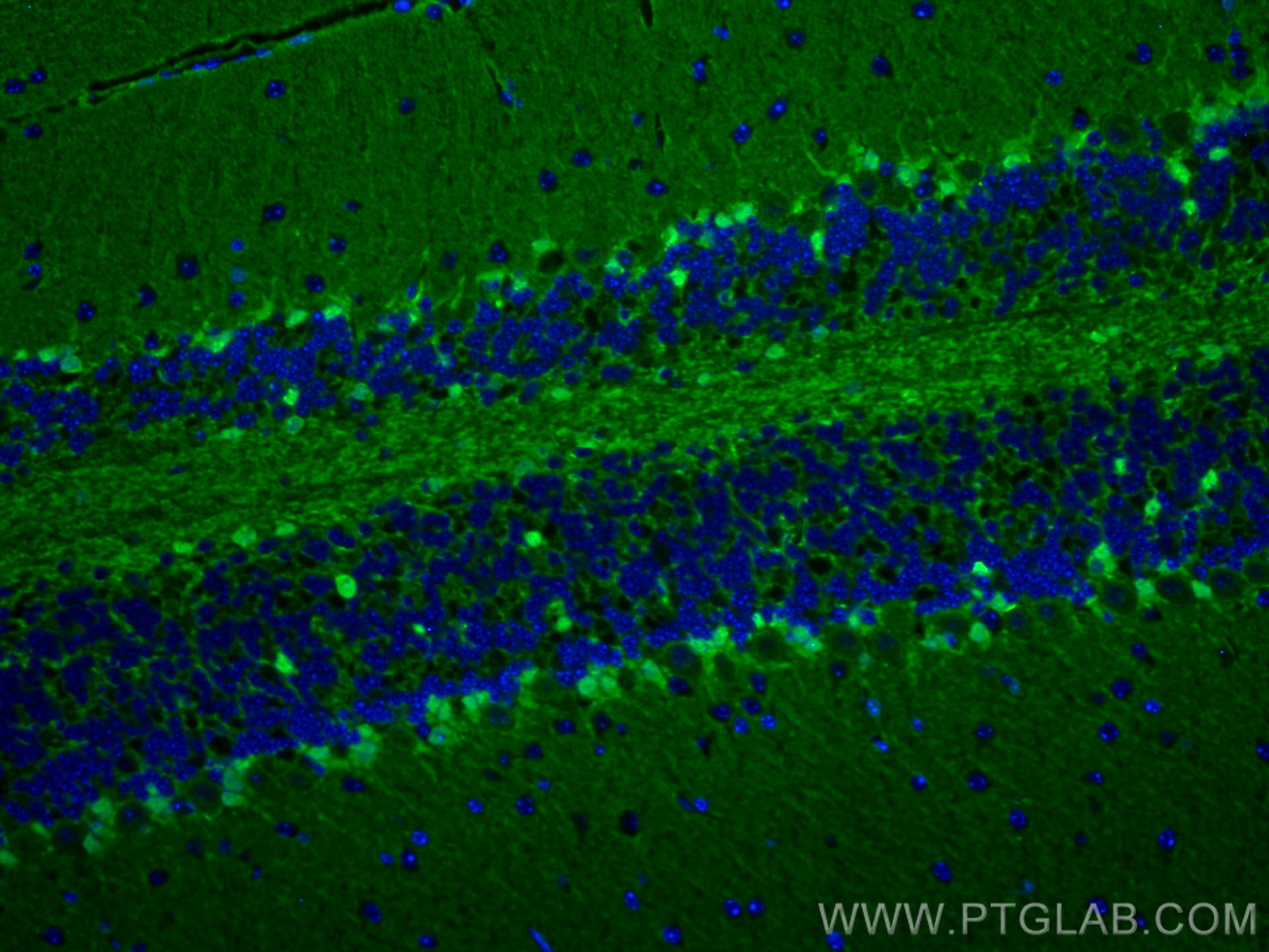 Immunofluorescence (IF) / fluorescent staining of mouse cerebellum tissue using S100 Beta Polyclonal antibody (15146-1-AP)