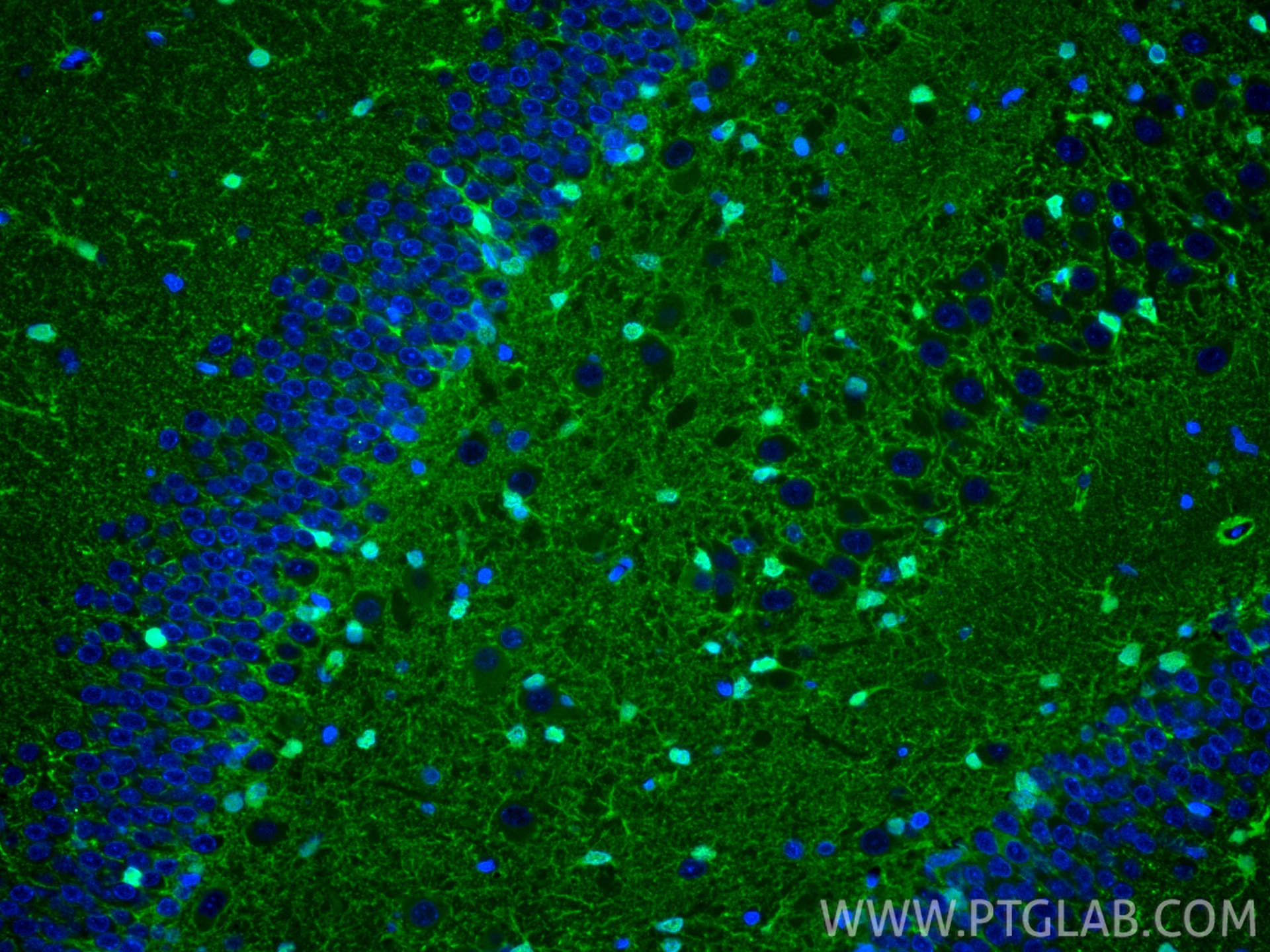 Immunofluorescence (IF) / fluorescent staining of rat brain tissue using S100B Polyclonal antibody (15146-1-AP)
