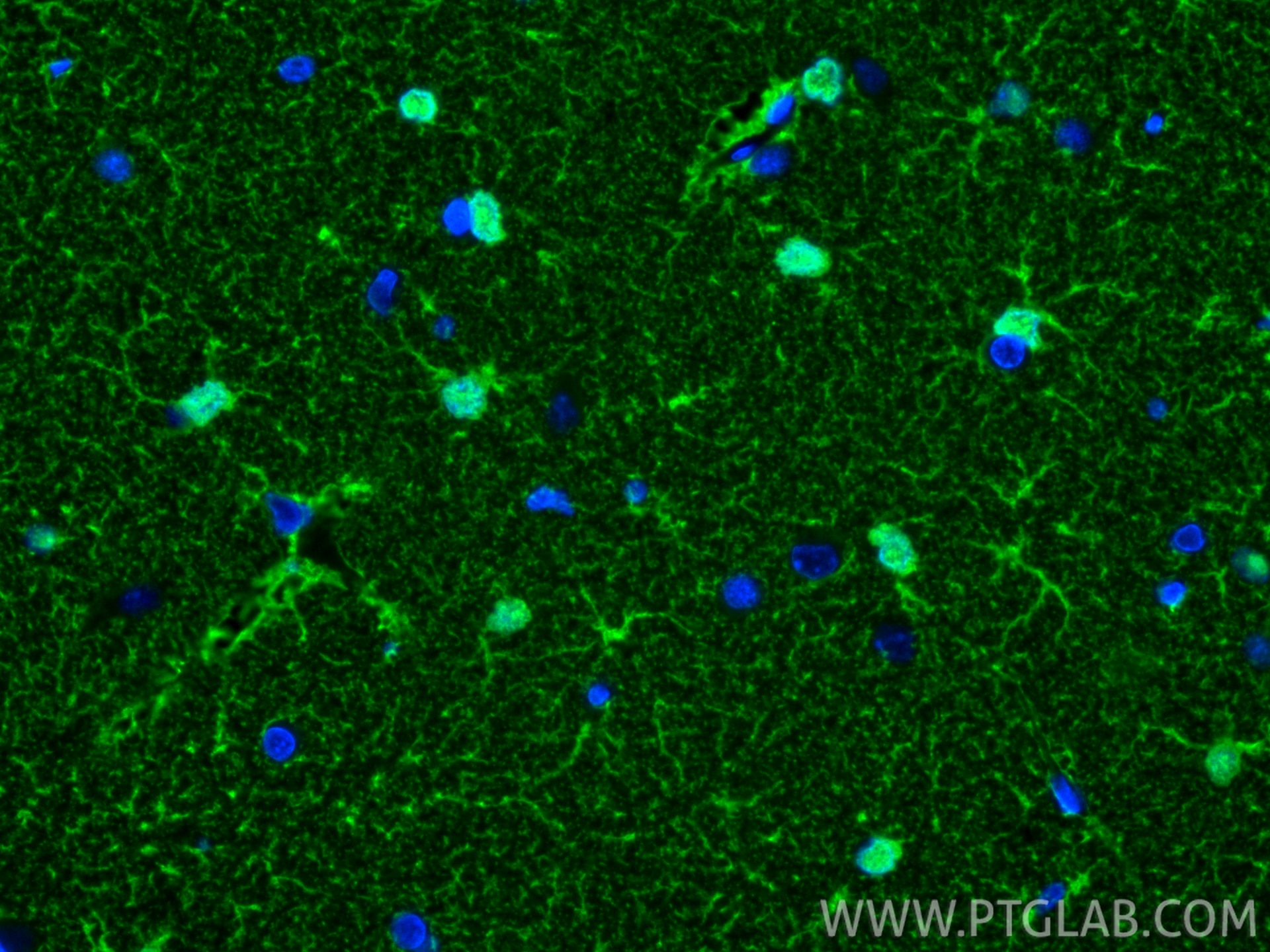 Immunofluorescence (IF) / fluorescent staining of rat brain tissue using S100B Polyclonal antibody (15146-1-AP)