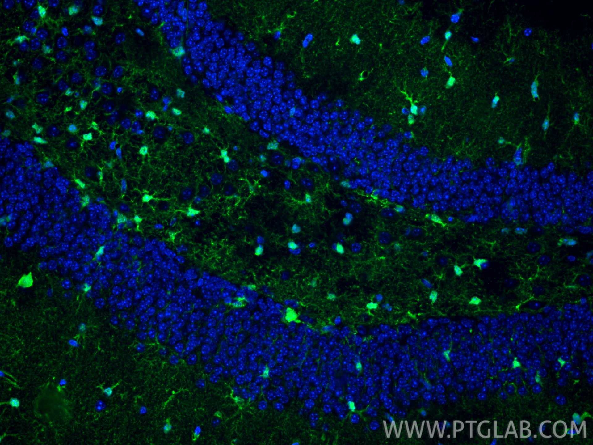 Immunofluorescence (IF) / fluorescent staining of mouse brain tissue using S100B Polyclonal antibody (15146-1-AP)