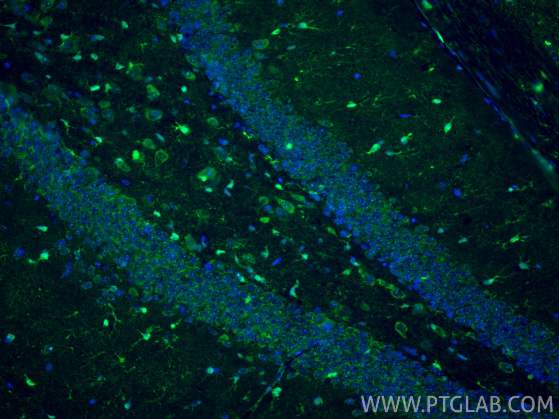 Immunofluorescence (IF) / fluorescent staining of mouse brain tissue using S100B Polyclonal antibody (15146-1-AP)
