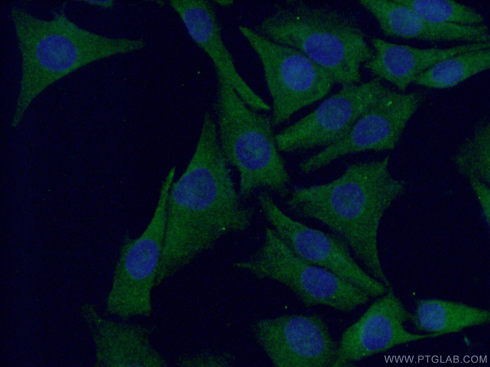 Immunofluorescence (IF) / fluorescent staining of A375 cells using S100 Beta Polyclonal antibody (15146-1-AP)