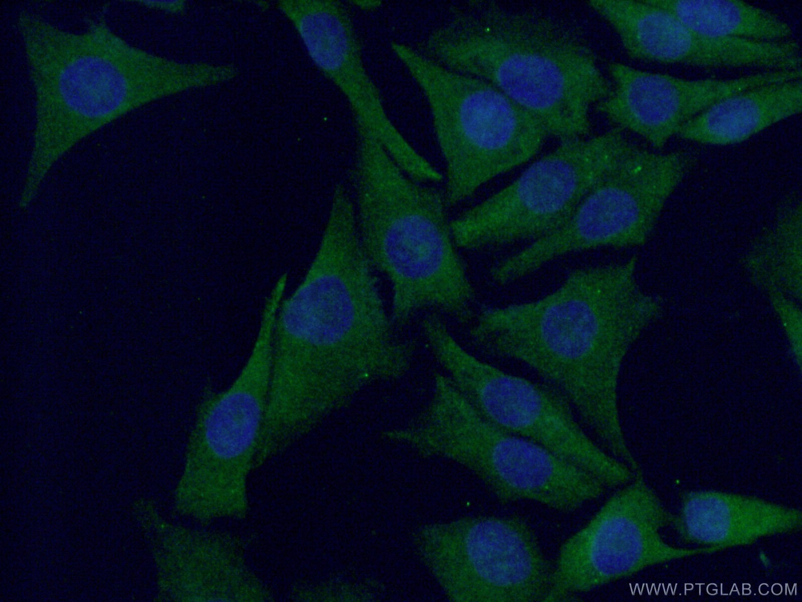 IF Staining of A375 using 15146-1-AP