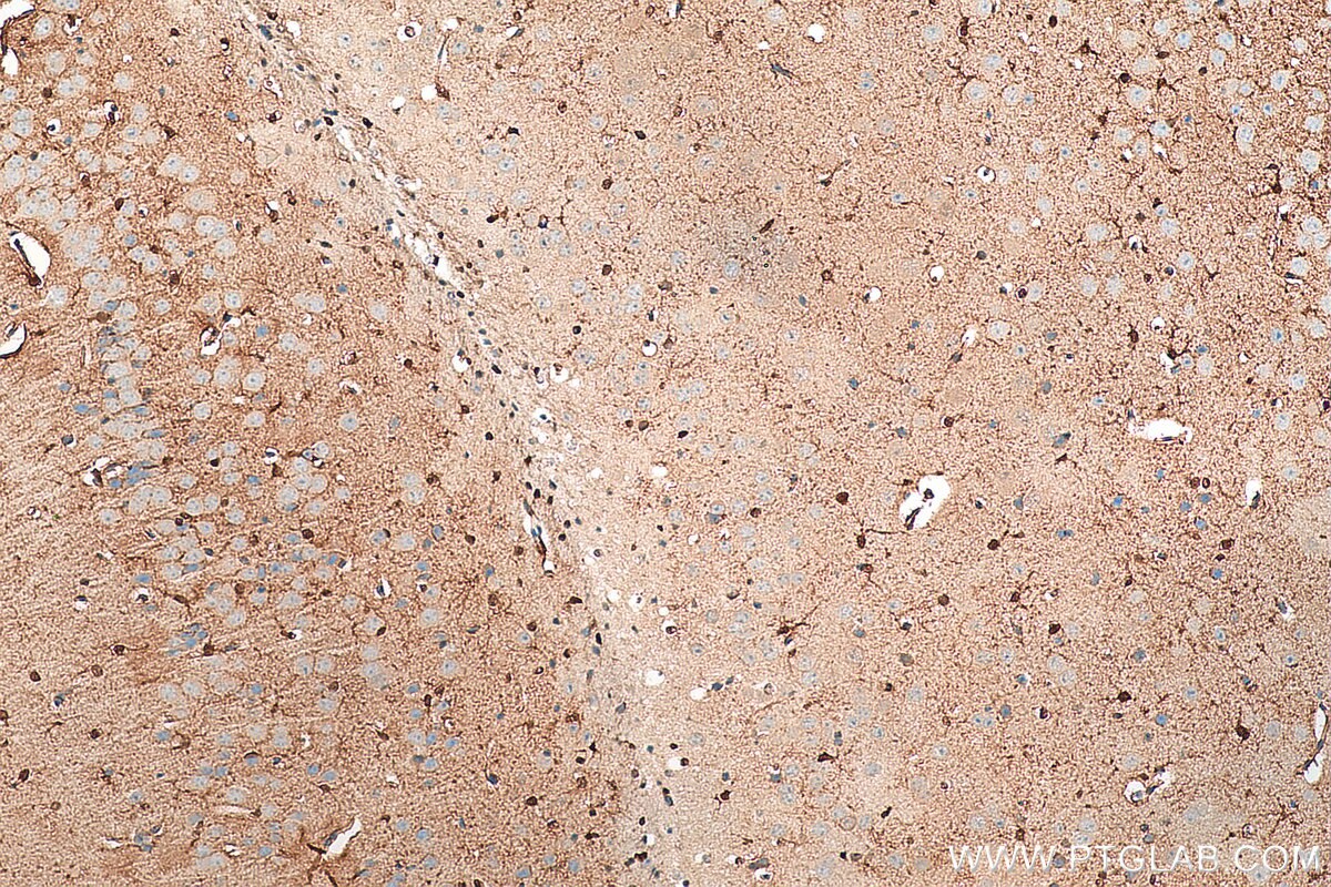 Immunohistochemistry (IHC) staining of mouse brain tissue using S100 Beta Polyclonal antibody (15146-1-AP)