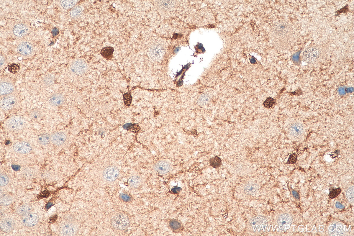 Immunohistochemistry (IHC) staining of mouse brain tissue using S100 Beta Polyclonal antibody (15146-1-AP)