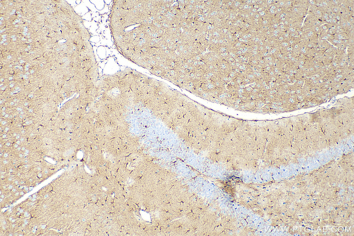 Immunohistochemistry (IHC) staining of mouse brain tissue using S100 Beta Polyclonal antibody (15146-1-AP)