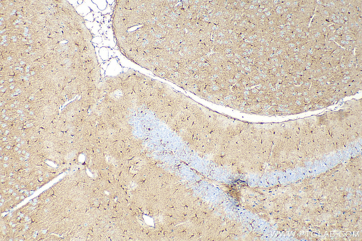 IHC staining of mouse brain using 15146-1-AP