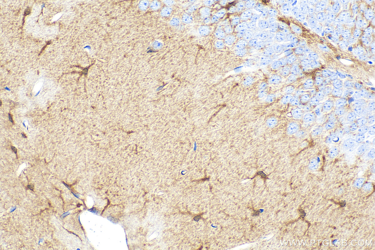 Immunohistochemistry (IHC) staining of mouse brain tissue using S100 Beta Polyclonal antibody (15146-1-AP)