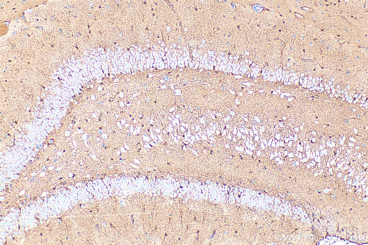 Immunohistochemistry (IHC) staining of rat brain tissue using S100B Polyclonal antibody (15146-1-AP)