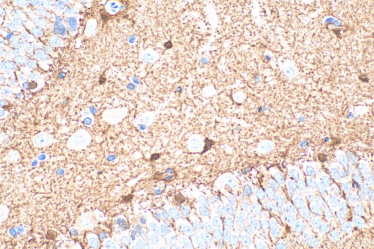 Immunohistochemistry (IHC) staining of rat brain tissue using S100B Polyclonal antibody (15146-1-AP)