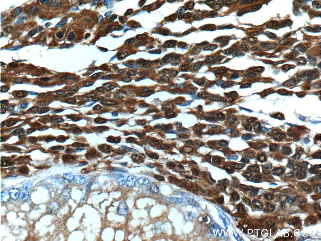 S100 Beta Polyclonal antibody