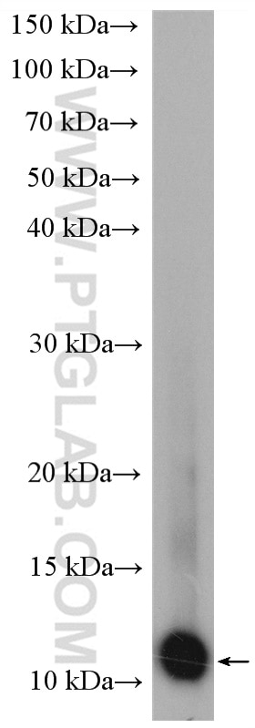 WB analysis of U-251 using 15146-1-AP