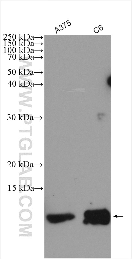 Western Blot (WB) analysis of various lysates using S100 Beta Polyclonal antibody (15146-1-AP)