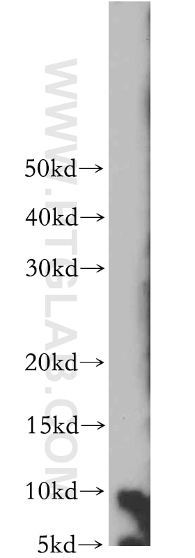 Western Blot (WB) analysis of mouse brain tissue using S100 Beta Polyclonal antibody (15146-1-AP)