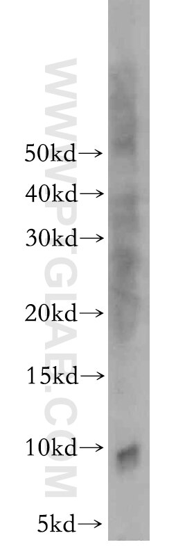 Western Blot (WB) analysis of human brain tissue using S100 Beta Polyclonal antibody (15146-1-AP)