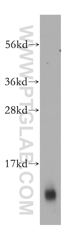 S100 Beta Polyclonal antibody