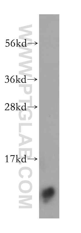 Western Blot (WB) analysis of human testis tissue using S100 Beta Polyclonal antibody (15146-1-AP)