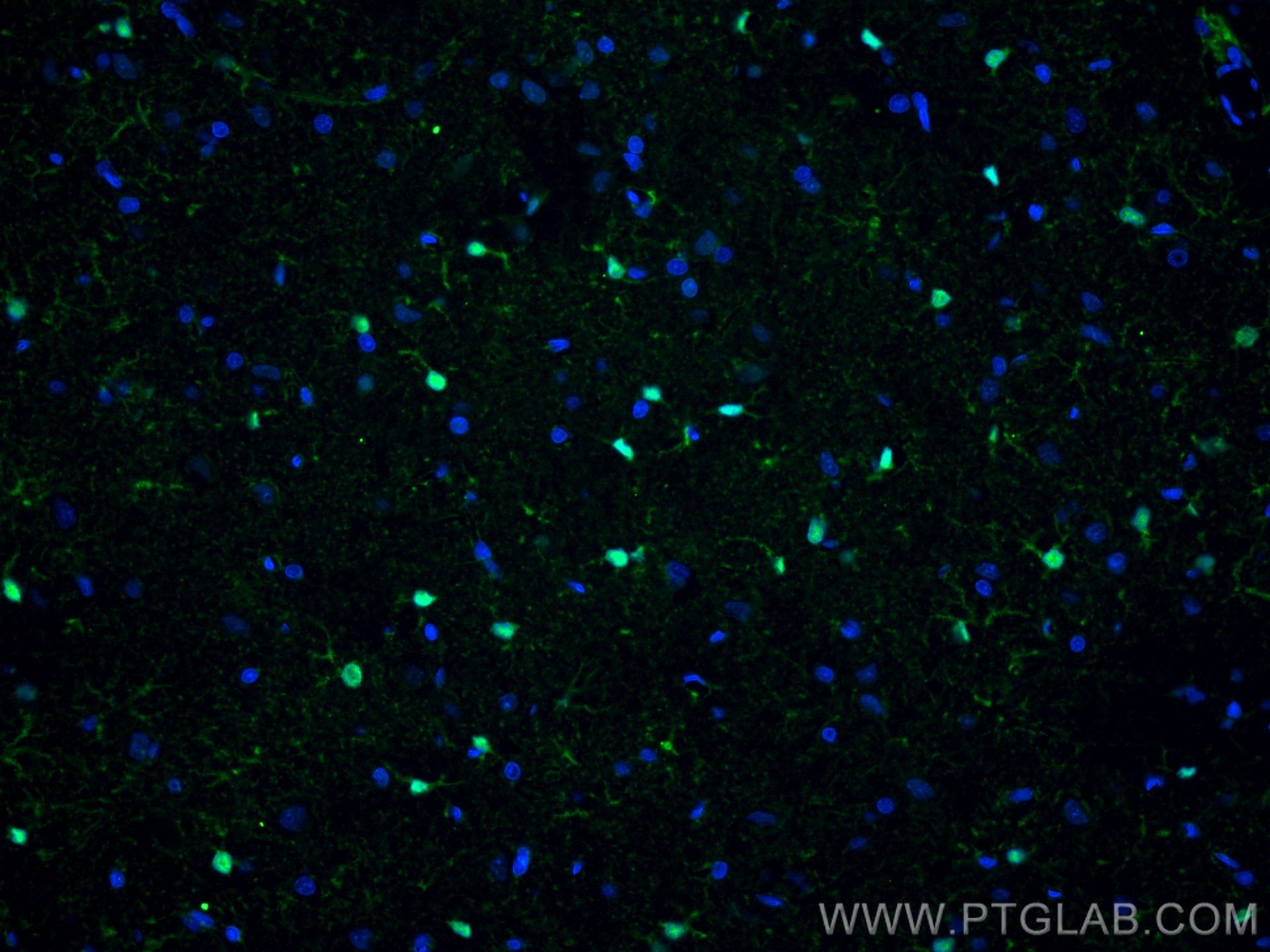 Immunofluorescence (IF) / fluorescent staining of rat brain tissue using S100 Beta Monoclonal antibody (66616-1-Ig)